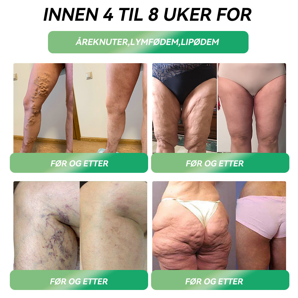 🎁Gratulerer! Du er en av våre heldige vinnere! 💪 Som vår eksklusive lykketrekning-stjerne får du nå nyte en fantastisk 20 % rabatt! Ikke gå glipp av denne sjeldne muligheten til å unne deg noe helt spesielt! 💫🛍️💫🛍️