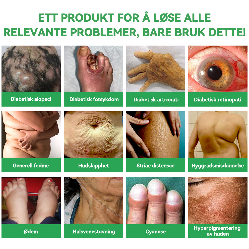 🎁Gratulerer! Du er en av våre heldige vinnere! 💪 Som vår eksklusive lykketrekning-stjerne får du nå nyte en fantastisk 20 % rabatt! Ikke gå glipp av denne sjeldne muligheten til å unne deg noe helt spesielt! 💫🛍️💫🛍️