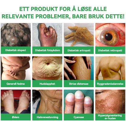 🎁Gratulerer! Du er en av våre heldige vinnere! 💪 Som vår eksklusive lykketrekning-stjerne får du nå nyte en fantastisk 20 % rabatt! Ikke gå glipp av denne sjeldne muligheten til å unne deg noe helt spesielt! 💫🛍️💫🛍️